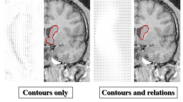 phd thesis radiology