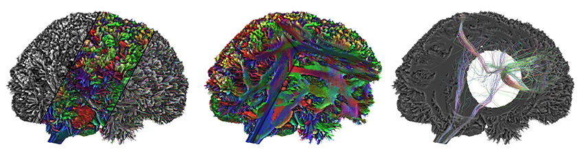 Fiblets for Real-Time Rendering of Massive Brain Tractograms