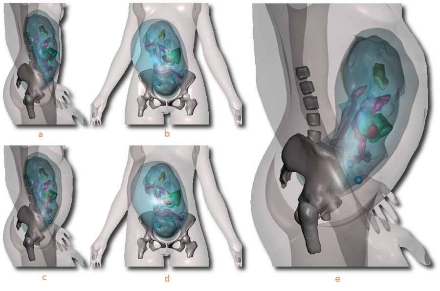 Physics-based Modeling of the Pregnant Woman