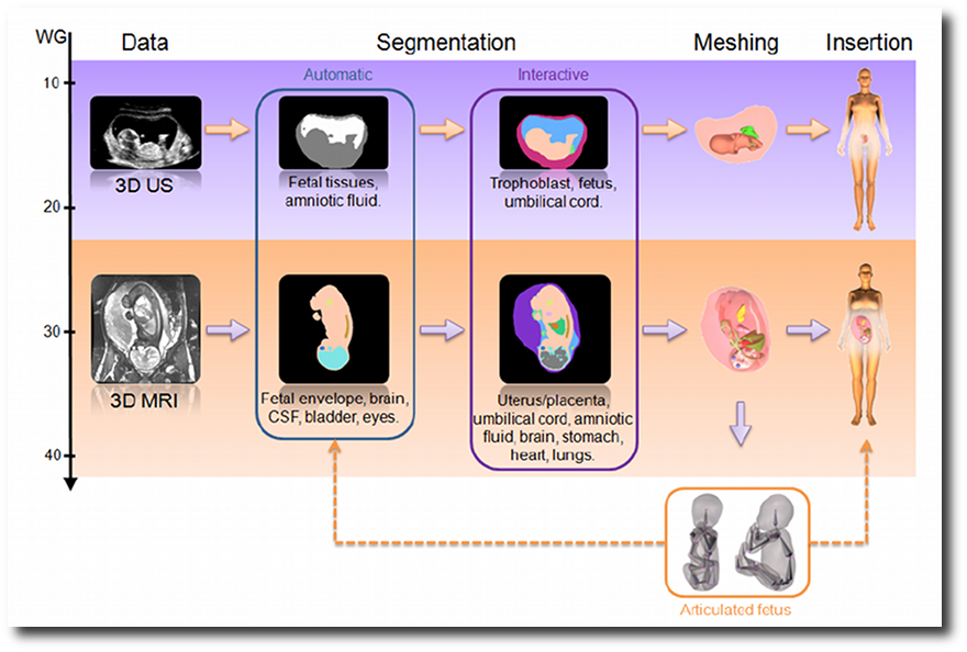 Whole Body Pregnant Woman Modeling By Digital Geometry Processing With Detailed Utero-Fetal Unit Based On Medical Images